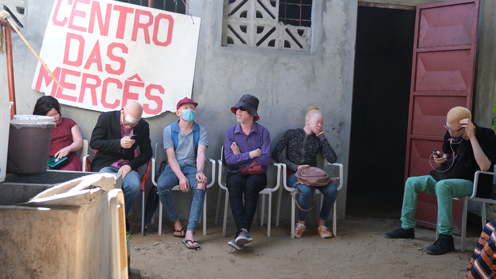 Wartebereich der Albinismus-Sprechstunde in Mozambik © Gary Hirson